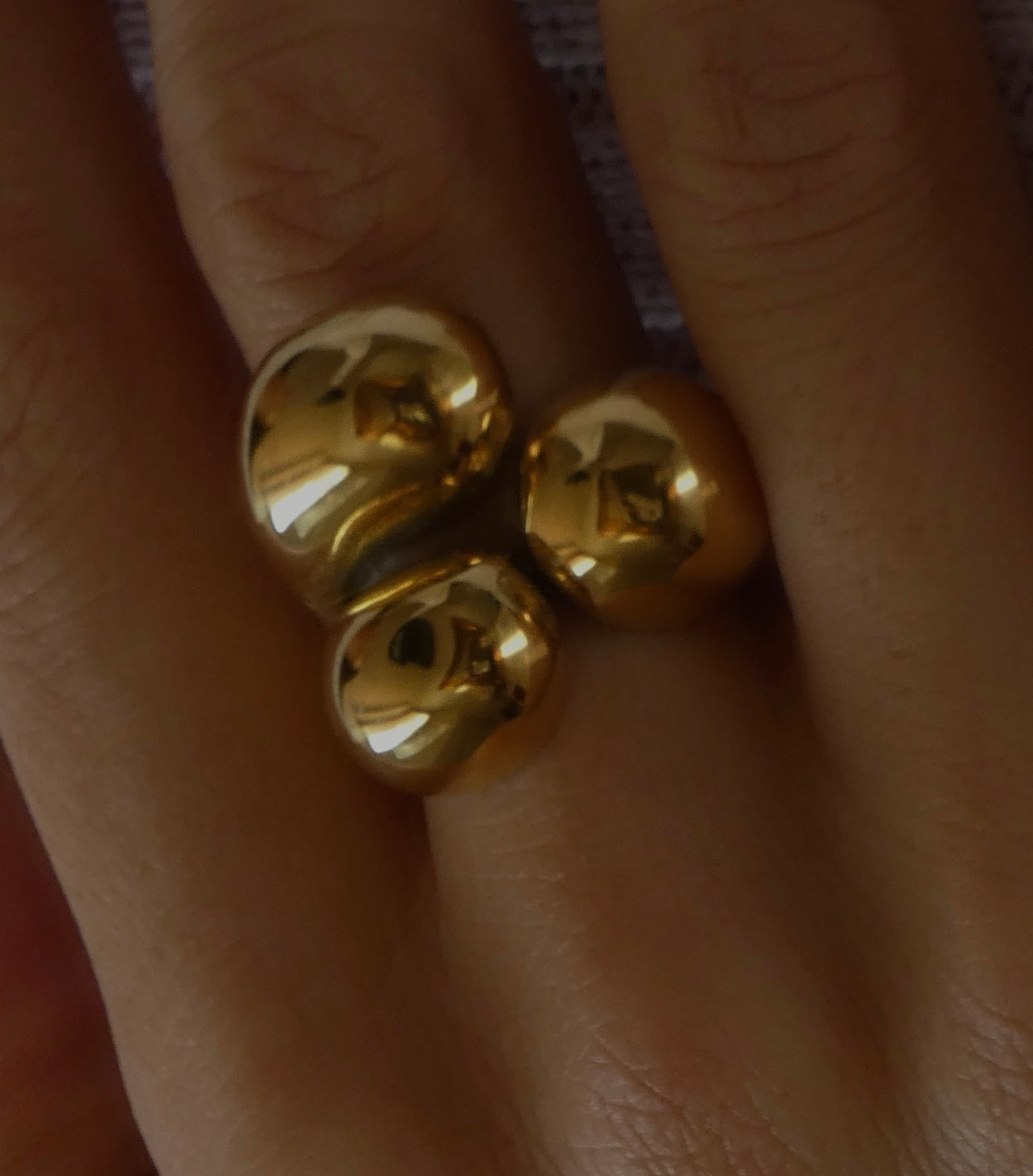 Anello Lis